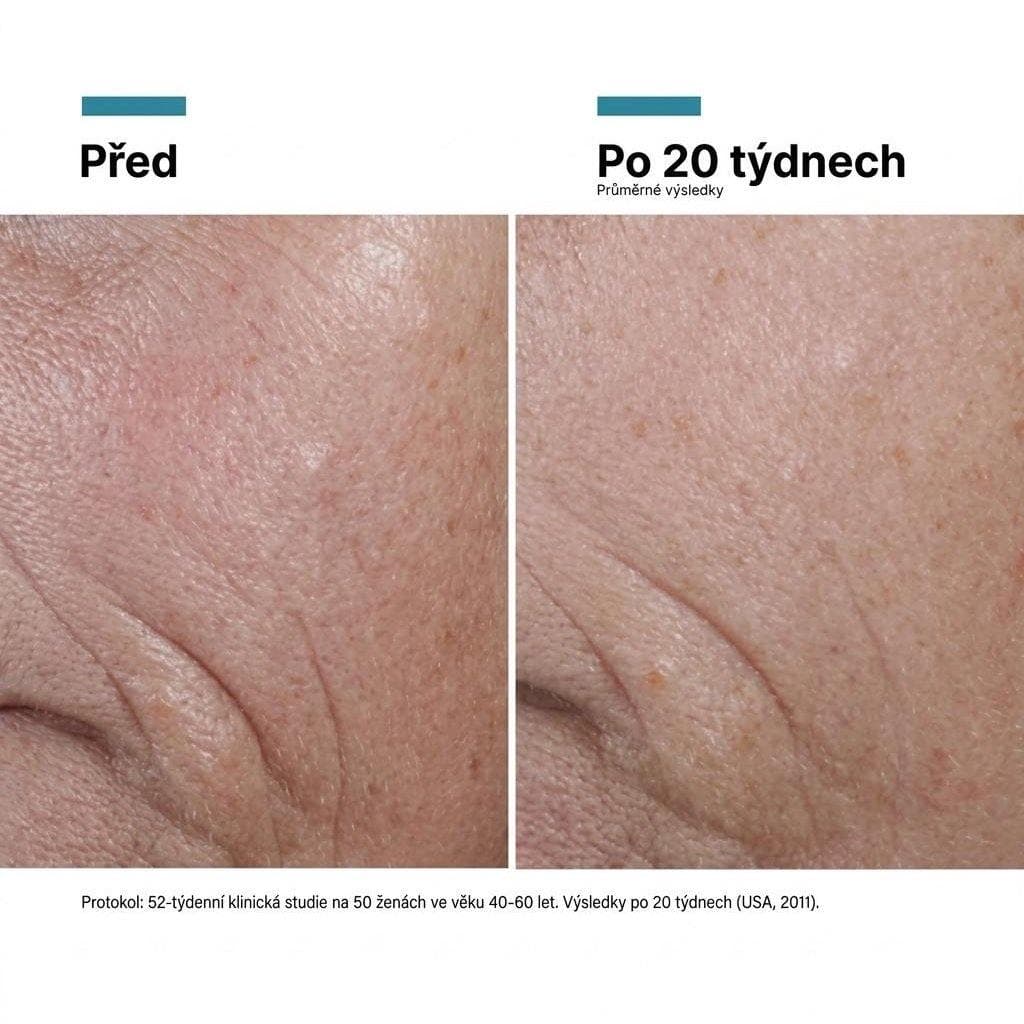 Výsledky před a po použití C E Ferulic séra